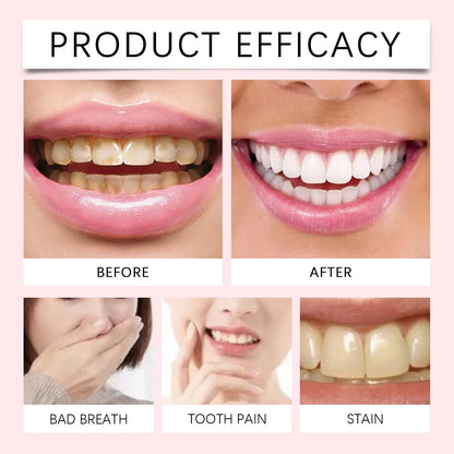 Oralhoe Niacinamide Toothpaste Remove Plaque Gentle Soothing Gum Stains Brightening Teeth Oral Deodorant Mint Dental Cleaning