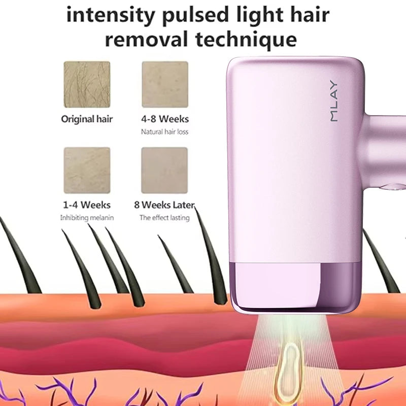 MLAY T14 IPL ICE Cooling IPL Laser Epilator Home Hair Removal Device Replaceable Face Body Bikini