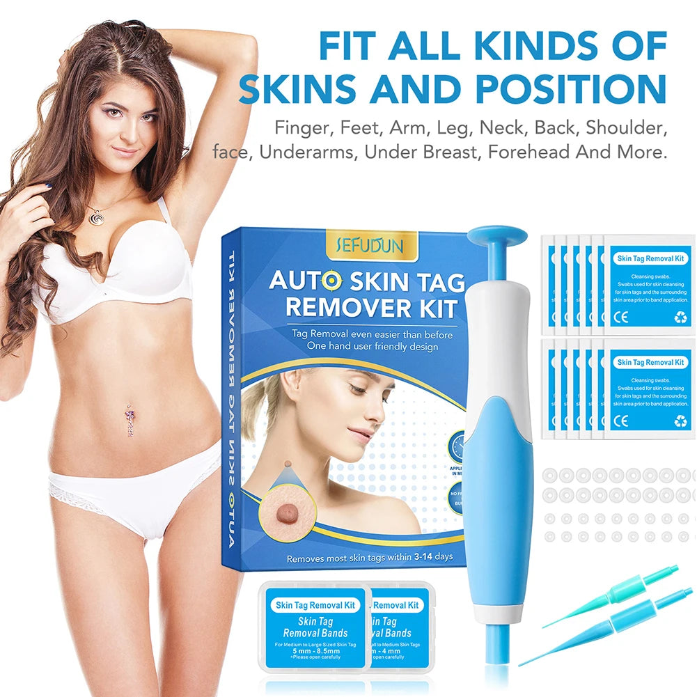 Rubber Rings Face Mole Removal Tool Kits Safety Painless Remove Skin Wart Kits Face Beauty Accessories for Neck Chin Back