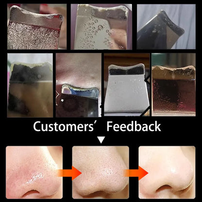 Electric Skin Scrubber Peeling Blackhead Remover Deep Face Cleaning Lifting Cleaner Facial Spatula Shovel Cleanser