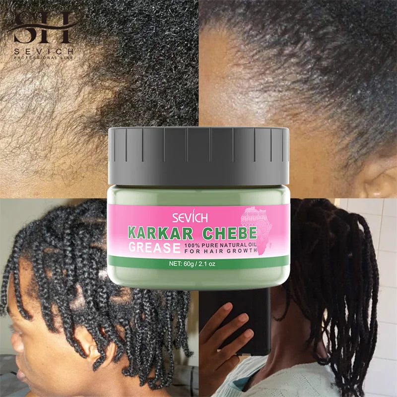 100% Pure Natural KARKAR Butter Hair Growth Oil Anti-Hair Loss Oil Repair Damaged Scalp Treatment Serum Oil For All Hair Types