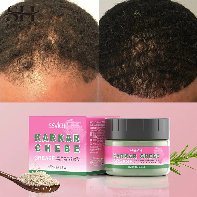 100% Pure Natural KARKAR Butter Hair Growth Oil Anti-Hair Loss Oil Repair Damaged Scalp Treatment Serum Oil For All Hair Types