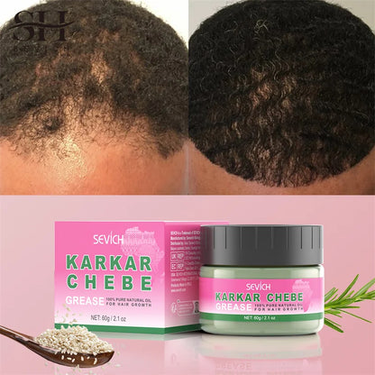 100% Pure Natural KARKAR Butter Hair Growth Oil Anti-Hair Loss Oil Repair Damaged Scalp Treatment Serum Oil For All Hair Types