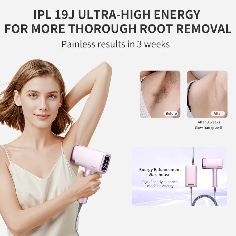 MLAY T14 IPL ICE Cooling IPL Laser Epilator Home Hair Removal Device Replaceable Face Body Bikini