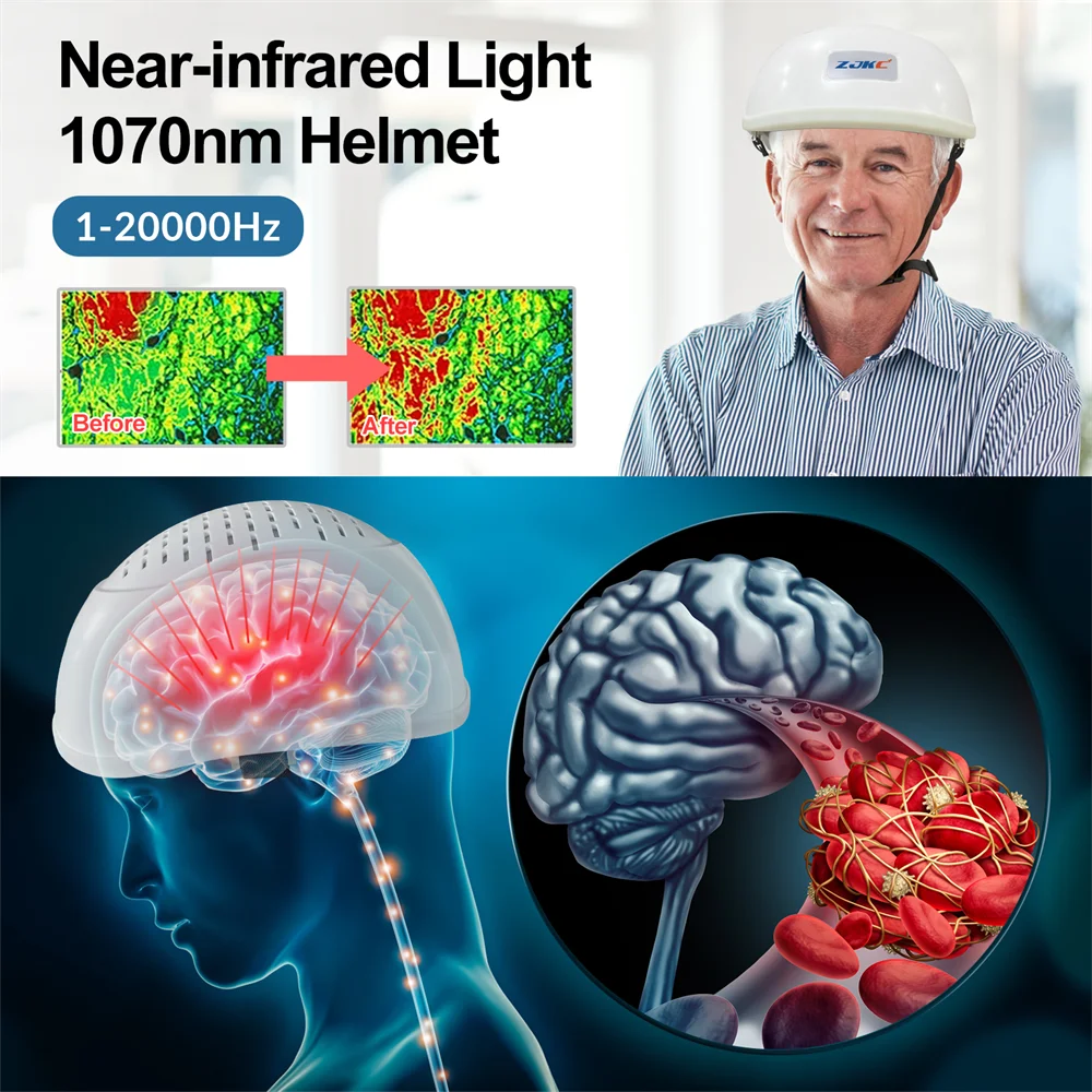 Infrared Light Helmet 1070nm Dementia Therapy Gadgets for Stroke Victims Boost The Brain Activities Enhance Cognition