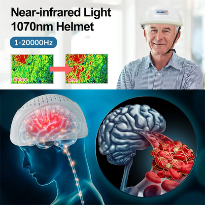 Infrared Light Helmet 1070nm Dementia Therapy Gadgets for Stroke Victims Boost The Brain Activities Enhance Cognition