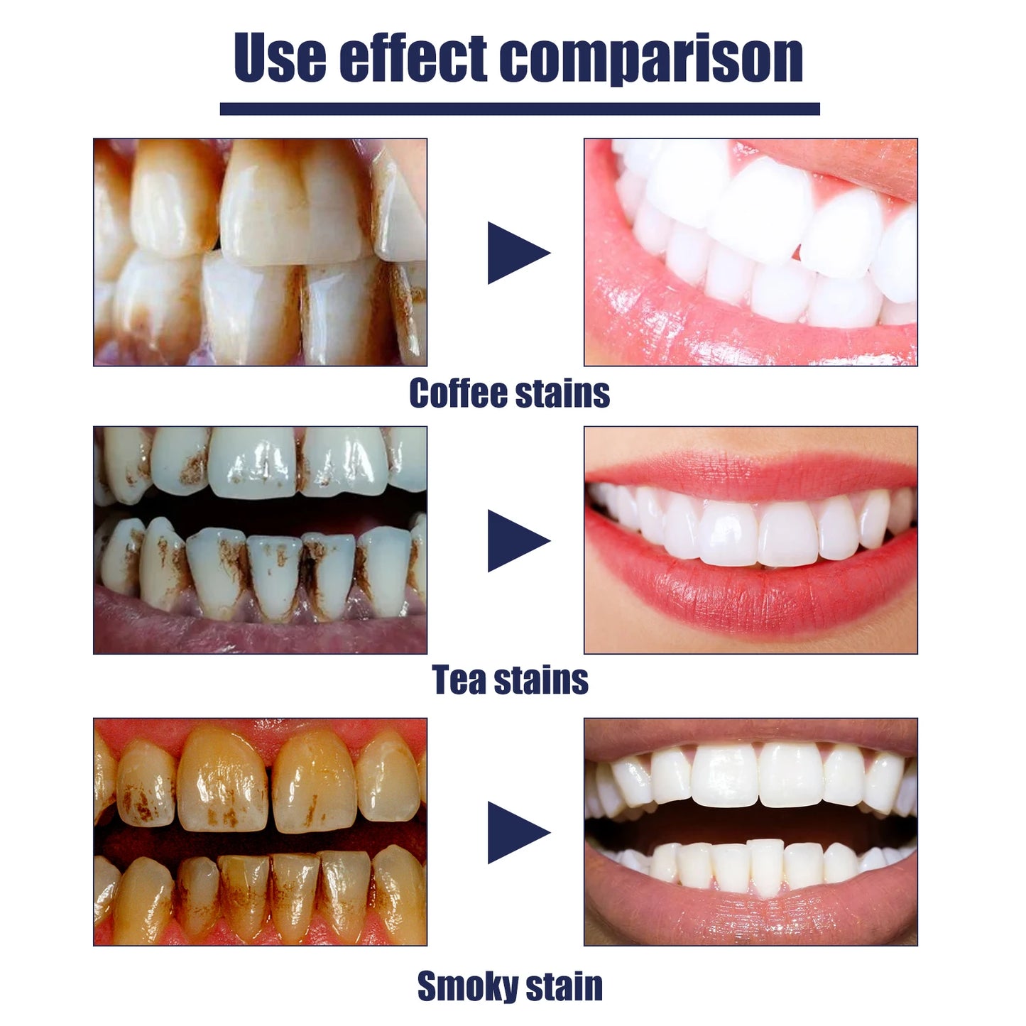 EELHOE 60ml Smokers Toothpaste Remove Coffee Tea Smoking Tooth Stains Naturally Effective Improve Bad Breath Teeth Deep Cleaning