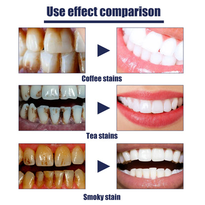 EELHOE 60ml Smokers Toothpaste Remove Coffee Tea Smoking Tooth Stains Naturally Effective Improve Bad Breath Teeth Deep Cleaning